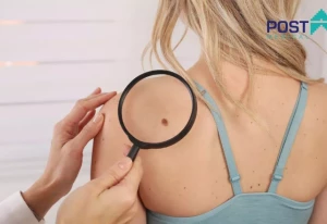 Nowy specjalista dermatolog