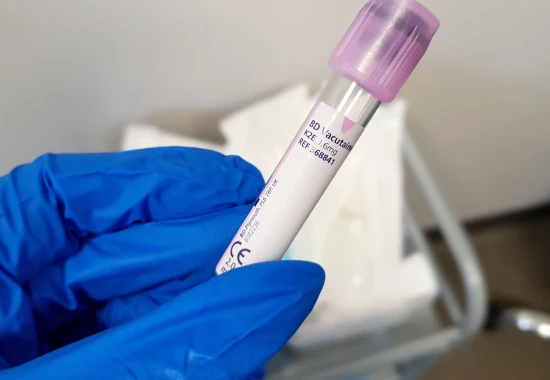 Zabieg osocza bogatopłytkowego (PRP) już dostępny w POST MEDICAL