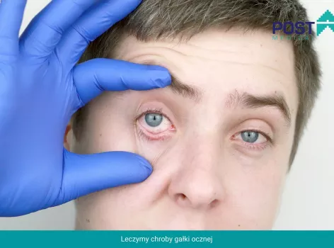 Okulista Mysłowice - leczenie - choroby gałki ocznej