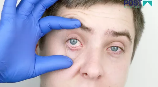 Okulista Ruda Śląska - leczenie - choroby gałki ocznej