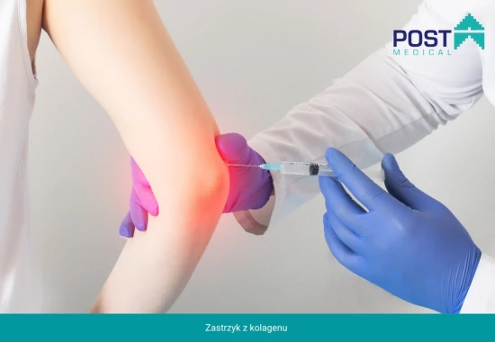 Kolagenowa terapia dla zdrowych stawów