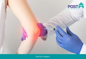 Kolagenowa terapia dla zdrowych stawów