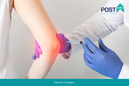 Kolagenowa terapia dla zdrowych stawów