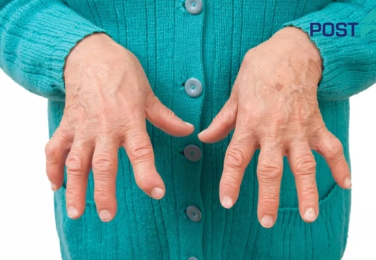 Reumatolog - dr n. med. Maria Głowacka-Kulesz