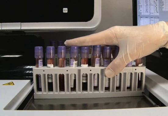 Otwarcie punktu pobrań ŚLA