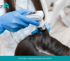Zadbaj o zdrowe i piękne włosy z trychologiem