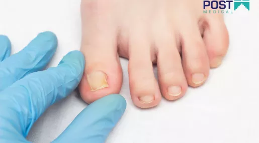 Chirurg Bytom - usuwanie wrastającego paznokcia